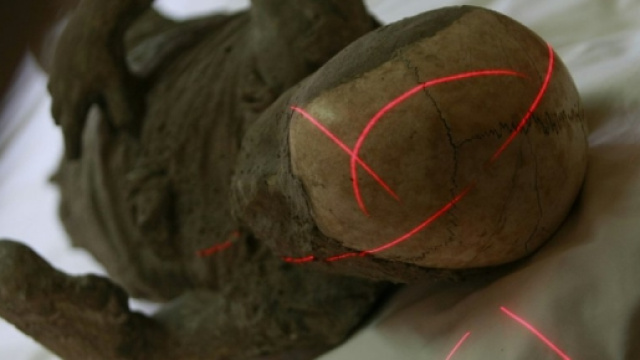 Tac multistrato sui calchi delle vittime di Pompei