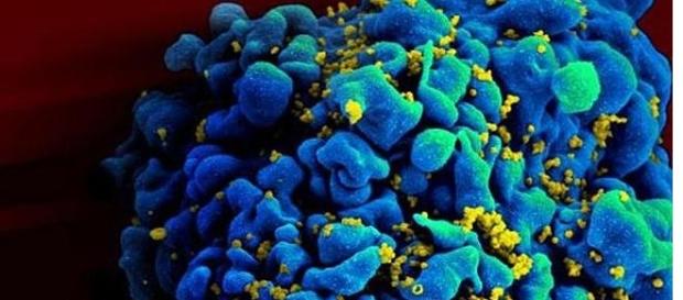 Celule albastre infectate cu HIV. Celule albastre infectate cu HIV.