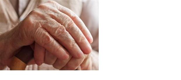 Alzheimer é a causa mais comum de demência Alzheimer é a causa mais comum de demência