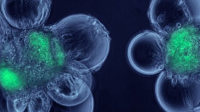 Cellule staminali per curare malattie gravi
