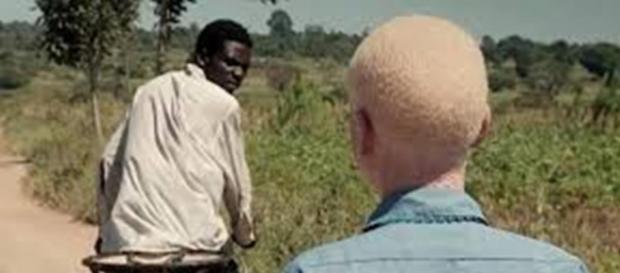 Albinos vítimas de sequestro em Moçambique Albinos vítimas de sequestro em Moçambique