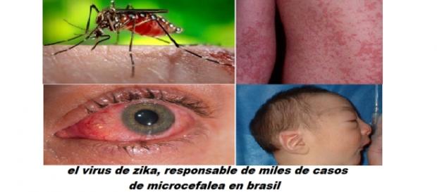 el virus de zika, nueva amenaza para la humanidad el virus de zika, nueva amenaza para la humanidad