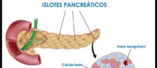 islotes pancreáticos y células Beta destruidas