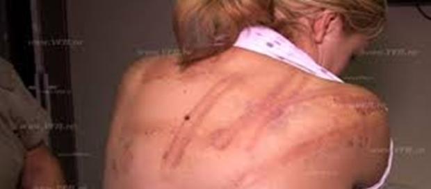 Abuzata sexual de la varsta de 5 ani Abuzata sexual de la varsta de 5 ani