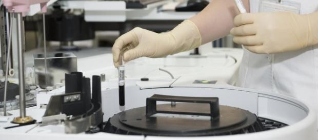 Zika: studio sulla trasmissione sessuale del virus Zika: studio sulla trasmissione sessuale del virus