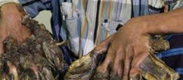 Crescimento de verrugas nos membros de Abul. Crescimento de verrugas nos membros de Abul.