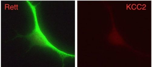 Neurone nella sindrome di Rett (Chen lab)