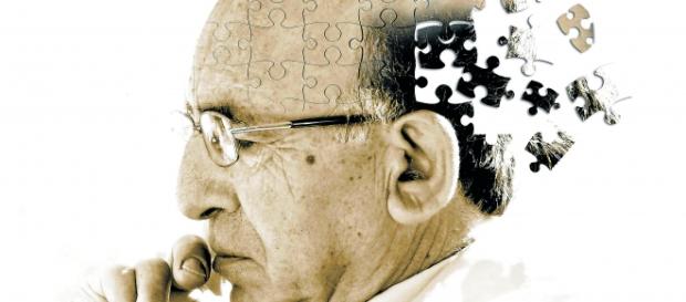 Alzheimer, a doença neuro-degenerativa incurável. Alzheimer, a doença neuro-degenerativa incurável.