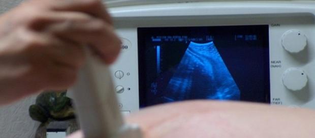 La autoinseminación está en auge en España. La autoinseminación está en auge en España.