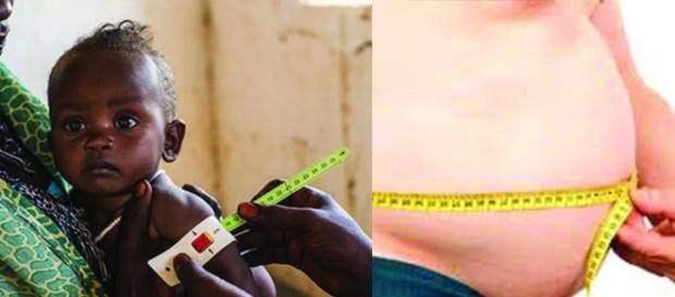 La paradoja entre morir de hambre o de obesidad La paradoja entre morir de hambre o de obesidad