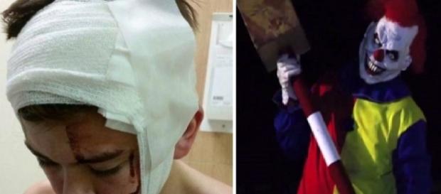 Menino é agredido por palhaço diabólico Menino é agredido por palhaço diabólico