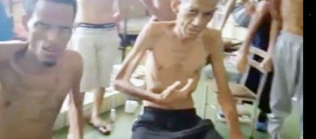 Imagem de presos passando fome e sofrendo com doenças Imagem de presos passando fome e sofrendo com doenças