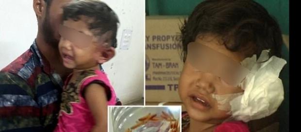 Imagens de larvas sendo retiradas do ouvido de garota Imagens de larvas sendo retiradas do ouvido de garota