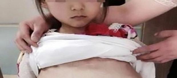 Menina de 12 anos, grávida, vítima do tráfico infantil. Menina de 12 anos, grávida, vítima do tráfico infantil.
