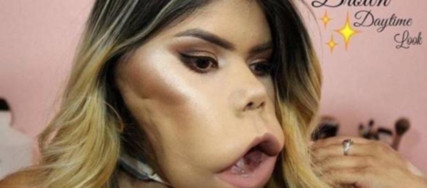 Má-formação não impediu esta garota de ser youtuber Má-formação não impediu esta garota de ser youtuber