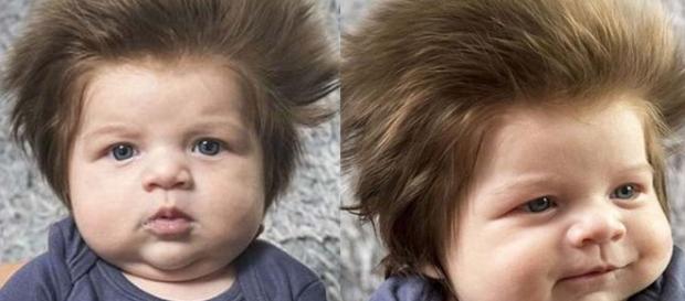 O pequeno é considerado o bebê mais peludo da internet O pequeno é considerado o bebê mais peludo da internet