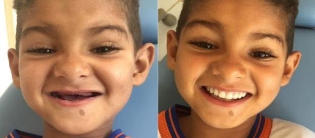 Ryan realizou seu sonho de ter dentes iguais aos dos coleguinhas Ryan realizou seu sonho de ter dentes iguais aos dos coleguinhas