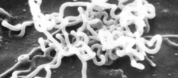 Sífilis é uma infecção causada pela bactéria Treponema pallidum Sífilis é uma infecção causada pela bactéria Treponema pallidum