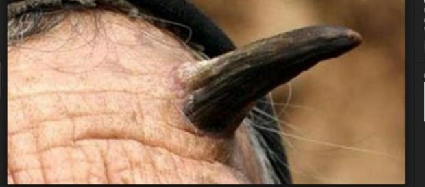 Mujer de más de 100 años le crece un cuerno en la frente Mujer de más de 100 años le crece un cuerno en la frente
