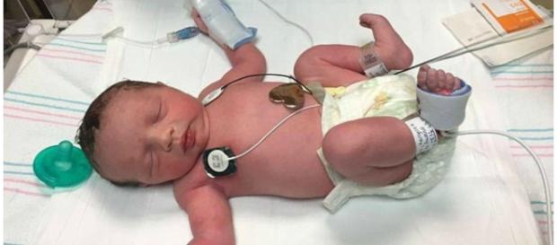 Lynlee nasceu por duas vezes, em um caso médico fantástico Lynlee nasceu por duas vezes, em um caso médico fantástico