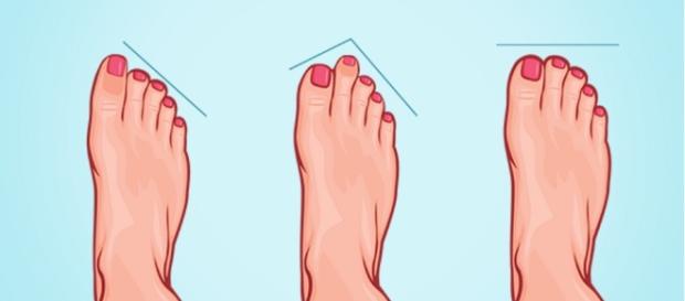 Os 3 tipos de pés existentes no mundo Os 3 tipos de pés existentes no mundo