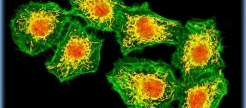 Cellule di glioblastoma e astrocitoma in replicazione (http://www.olympusmicro.com/galleries/confocal/cells/u118/u118sb0.html)