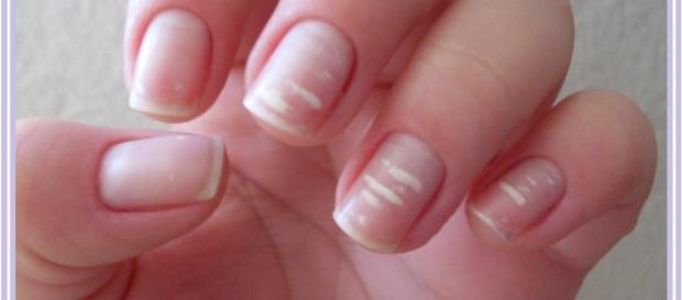 Dicas & Curiosidades sobre Unhas - blogspot.com Dicas & Curiosidades sobre Unhas - blogspot.com