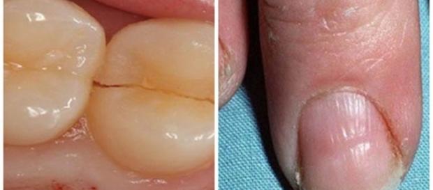 Sinais de que pode estar muito doente Sinais de que pode estar muito doente