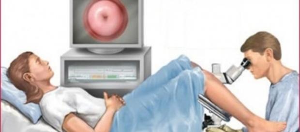 Realizando exame preventivo Papanicolau Realizando exame preventivo Papanicolau