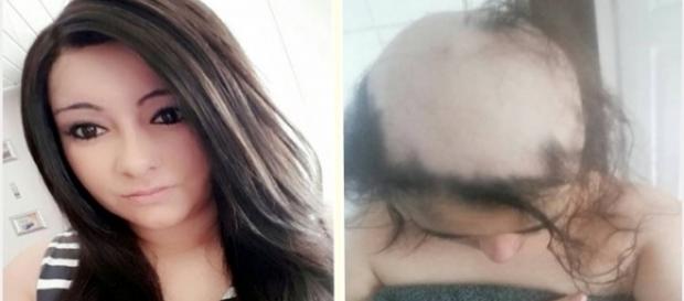 Ashleigh Algotaibi era uma jovem bonita com longos cabelos até que seu relacionamento a fez ficar quase totalmente careca. Ashleigh Algotaibi era uma jovem bonita com longos cabelos até que seu relacionamento a fez ficar quase totalmente careca.