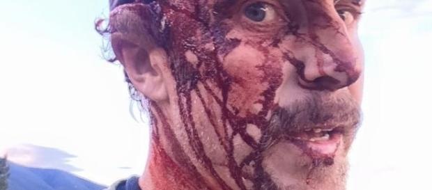 Imagem de homem atacado por urso. Imagem de homem atacado por urso.