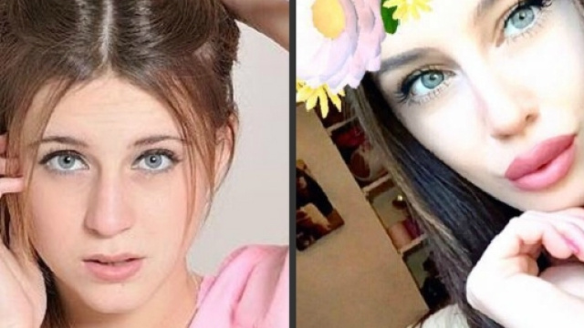 Asia Nuccetelli prima e dopo la chirurgia.