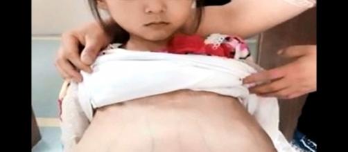 Menina de 12 anos, grávida de três meses, foi levada a um hospital chinês (Crédito: YouTube/LordSpoda)