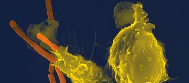 Bacteria resposable de la epidemia ántrax Bacteria resposable de la epidemia ántrax