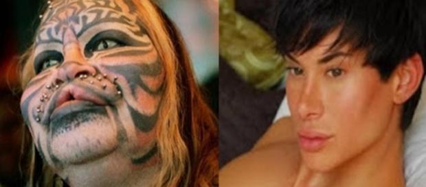 Essas pessoas abusaram da cirurgia para mudar seu visual Essas pessoas abusaram da cirurgia para mudar seu visual