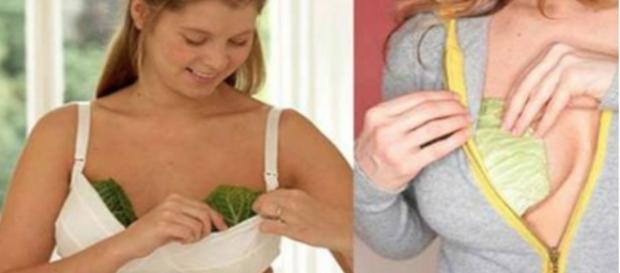 Mulheres colocando folha de repolho no seio Mulheres colocando folha de repolho no seio