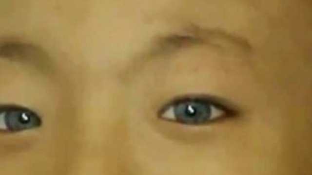 Chine : l'enfant aux yeux de chat