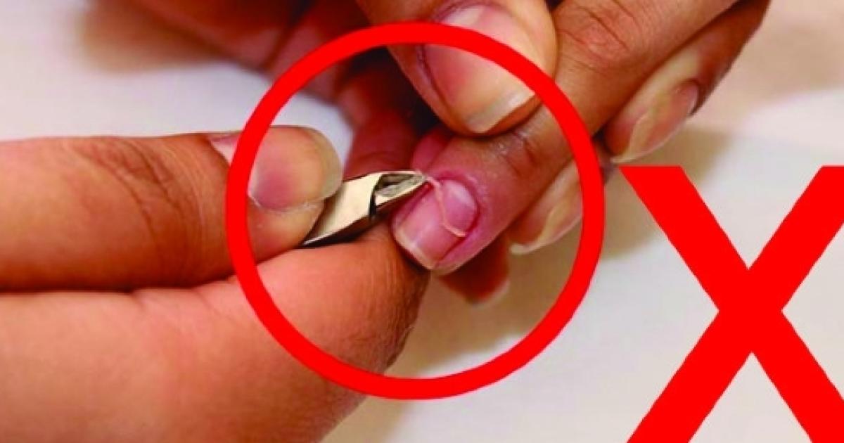 Importante: você pode estar em perigo ao tirar as cutículas