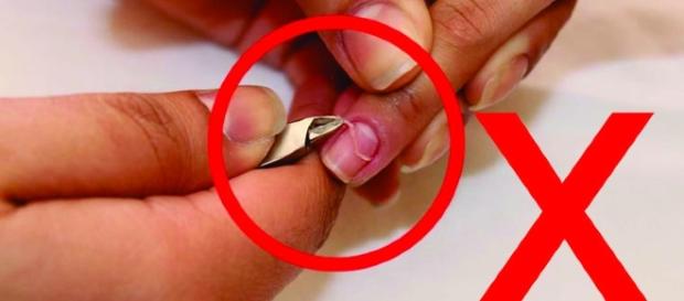 Dermatologista e especialista em unhas aconselha que você não deve cortar sua cutícula Dermatologista e especialista em unhas aconselha que você não deve cortar sua cutícula