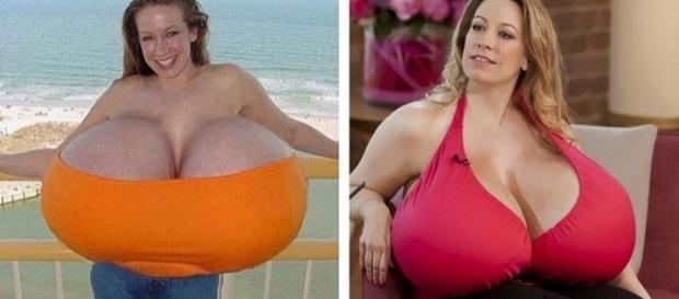 Ela possui seios gigantes e uma substância perigosa em seu corpo, mas ainda assim, ama seus implantes Ela possui seios gigantes e uma substância perigosa em seu corpo, mas ainda assim, ama seus implantes