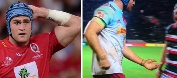 James Horwill quebra o seu dedo ao meio durante a partida de rúgbi James Horwill quebra o seu dedo ao meio durante a partida de rúgbi
