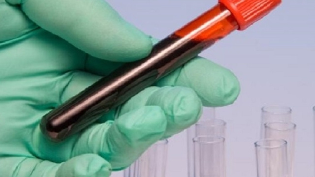 Sar&agrave; sufficiente un campione di sangue per una diagnosi precoce di almeno 100 forme differenti di tumore.