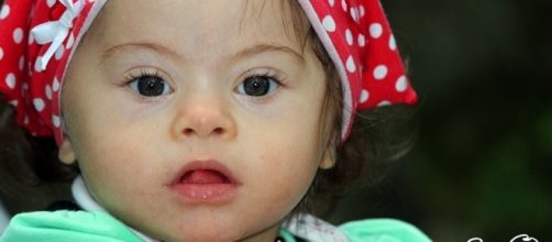 Gli occhi dei bimbi con sindrome di Down - Sindrome di Down ... - guardaconilcuore.org