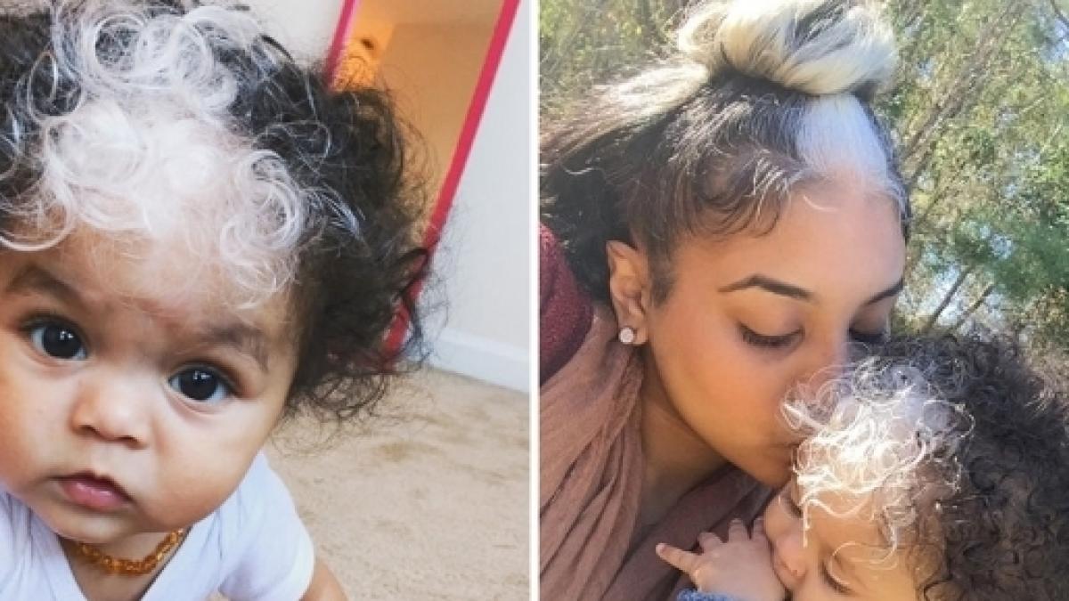 Baby Girl Born With White Hair Just Like Her Mother Grandmother