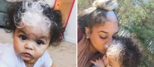 Baby takes after three generations born with white streak in hair - Photo: Blasting News Library - nydailynews.com