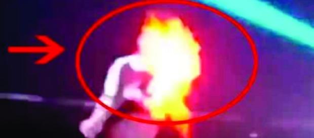 Michael Jackson sofre acidente grave: seu cabelo pega fogo Michael Jackson sofre acidente grave: seu cabelo pega fogo