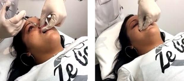 Sarah n'a plus de limite dans le partage de ses opérations de chirurgie (Snapchat : Sarah Fraisou) Sarah n'a plus de limite dans le partage de ses opérations de chirurgie (Snapchat : Sarah Fraisou)