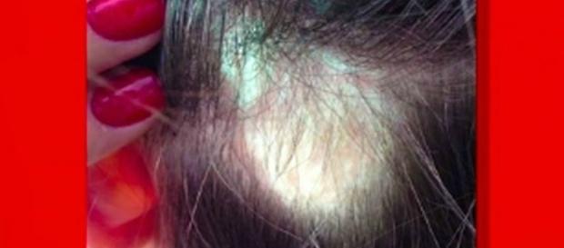Shampoo usado pelas famosas pode causar calvície. Shampoo usado pelas famosas pode causar calvície.