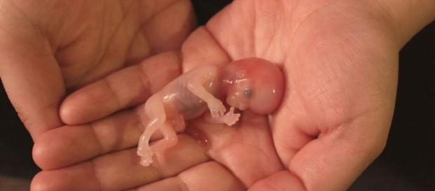 3 meses: ainda não é uma vida? 3 meses: ainda não é uma vida?