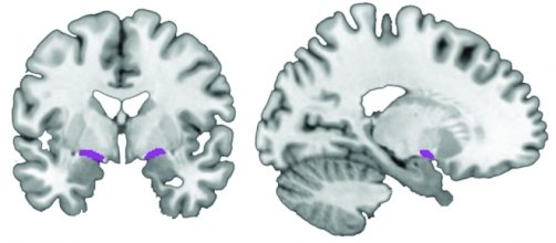 Un'immagine dello studio con il basal forebrain, area da cui prenderebbe origine l'Alzheimer, indicato in viola